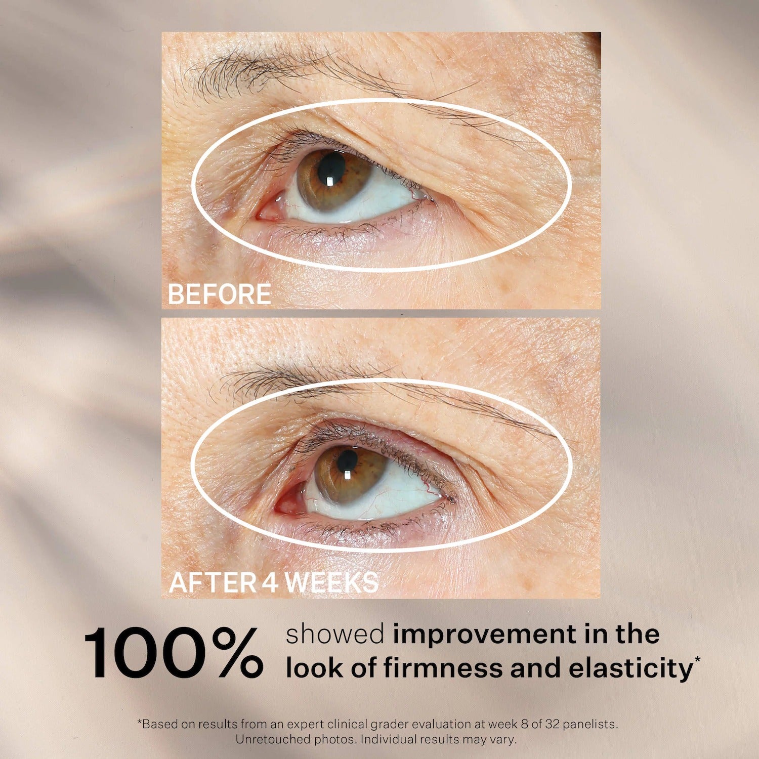StriVectin | Peptight ™ 360˚ Tightening Eye Serum