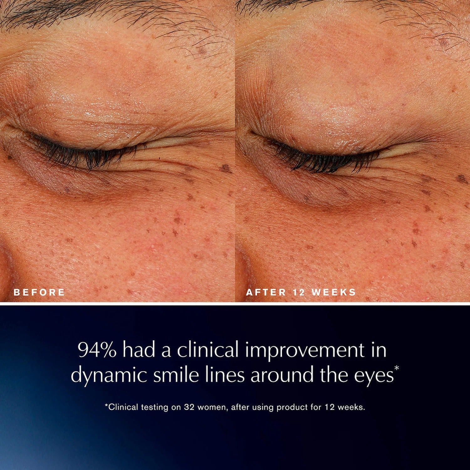 Estée Lauder | Advanced Night Repair Eye Lift + Sculpt Eye Cream