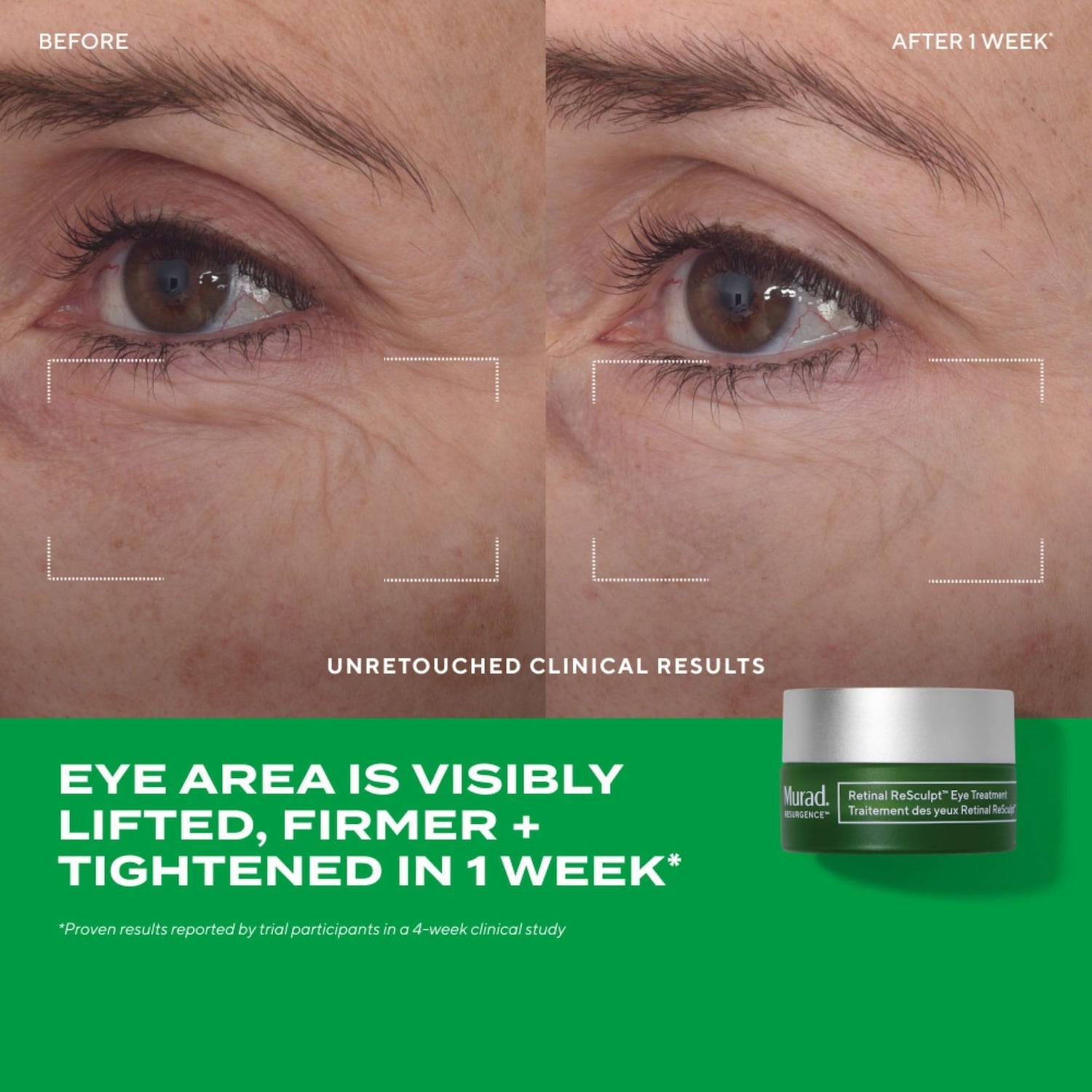 Murad | Retinal Resculpt Advanced Eye Lift Treatment for Aging Skin