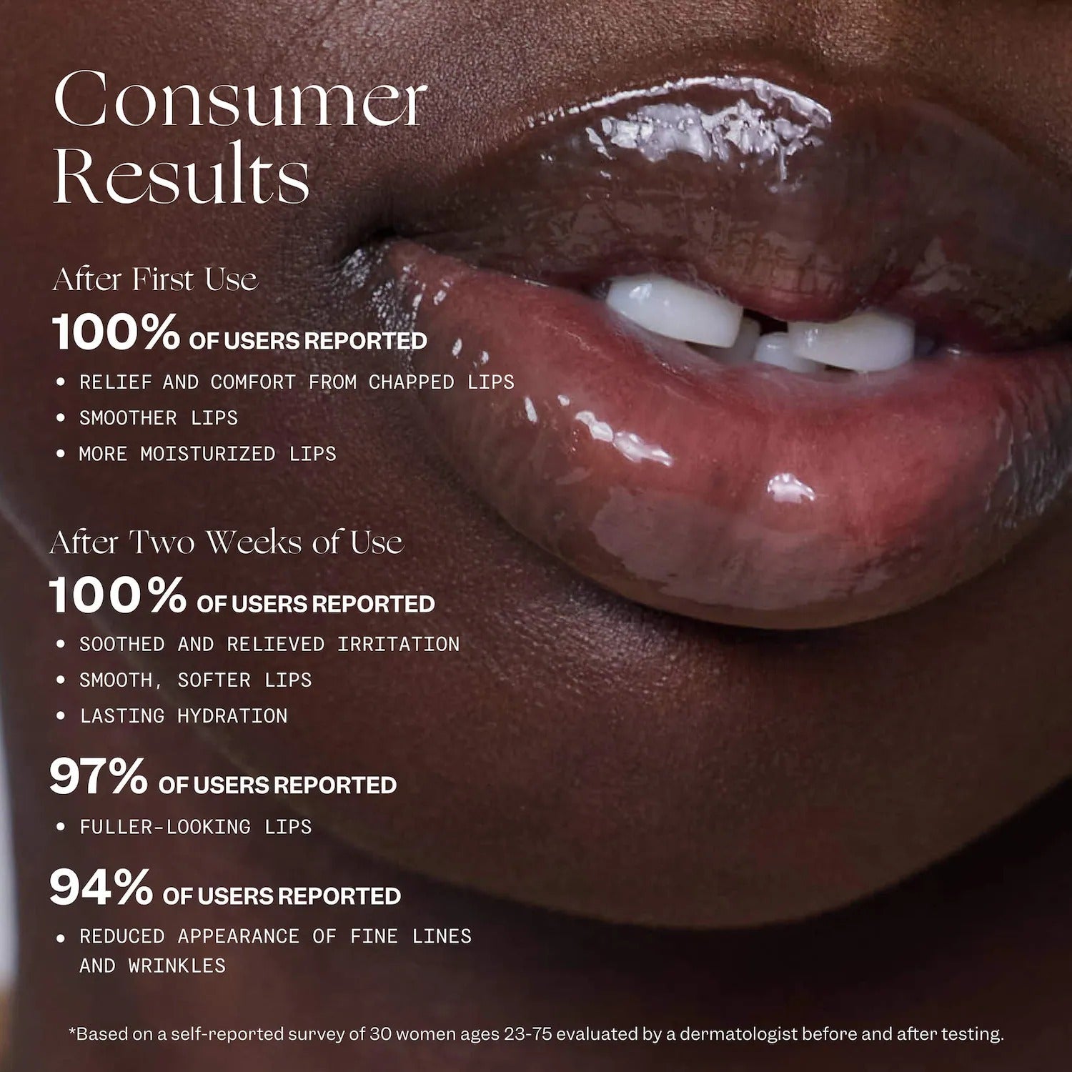 VIOLETTE_FR | BALM AMOUR Nourishing Lip Treatment with Peptides