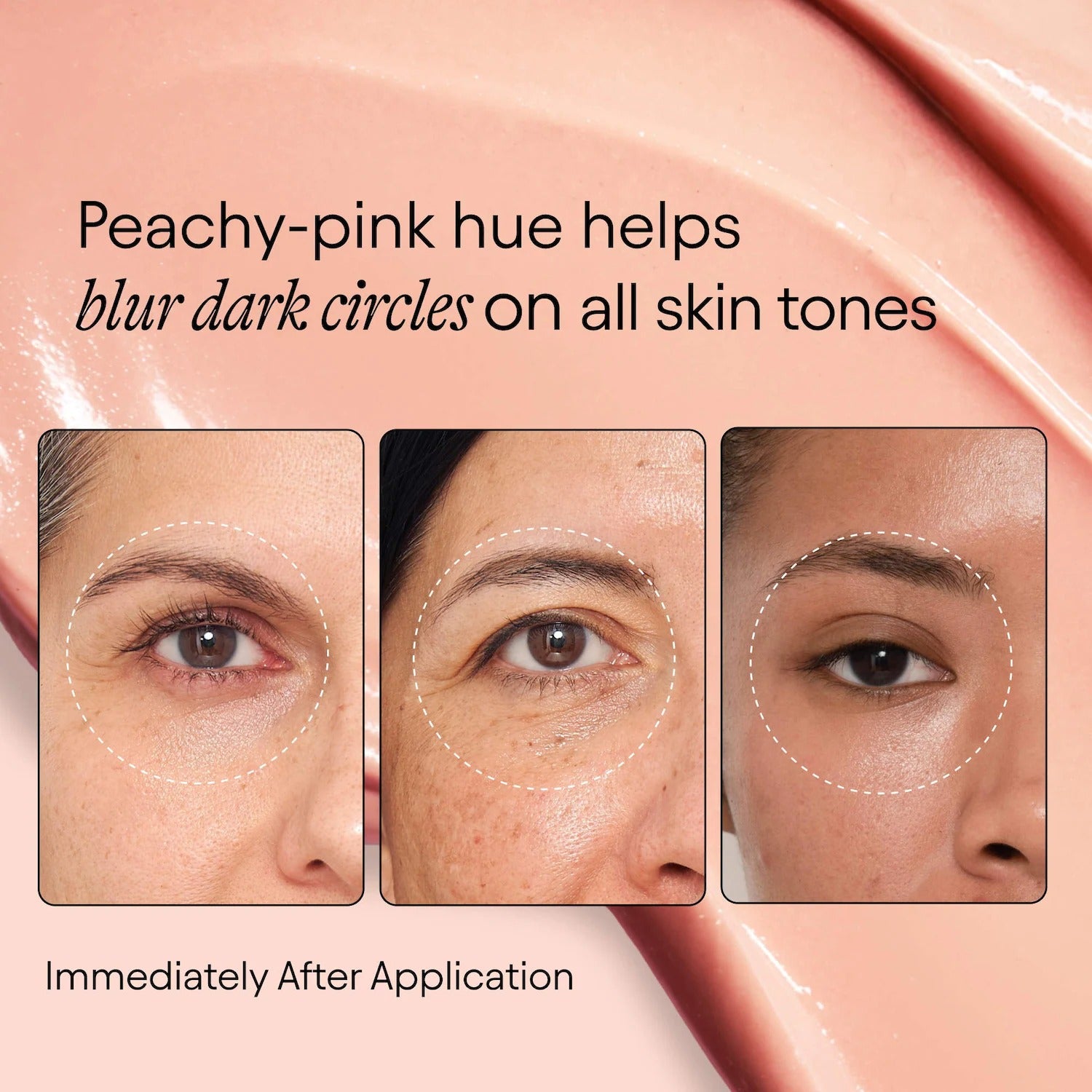 ALPYN |Instant Bright Eye Dark Circle Firming Cream with Niacinamide &amp; Peptides