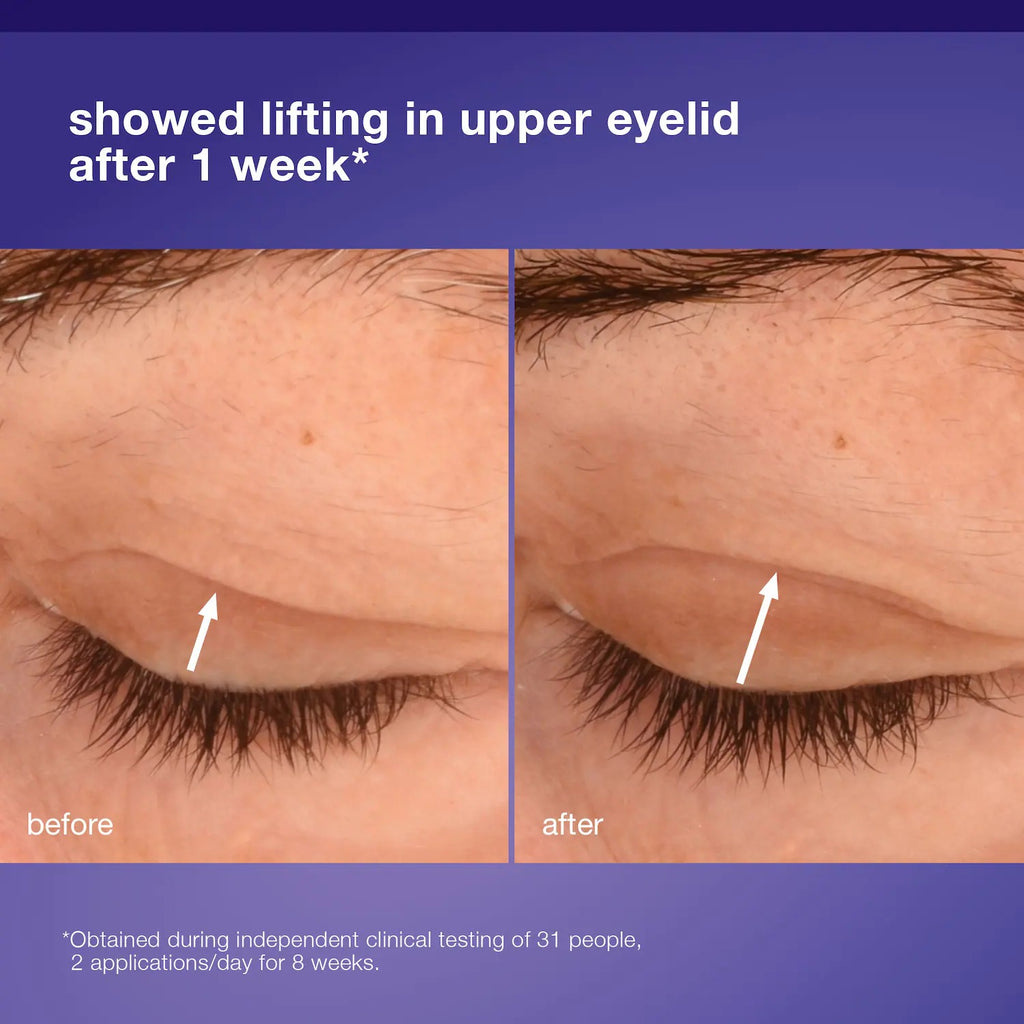 Dermalogica | Phyto Nature Lifting Eye Cream