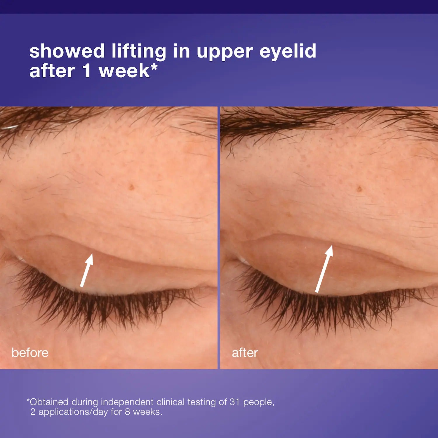 Dermalogica | Phyto Nature Lifting Eye Cream