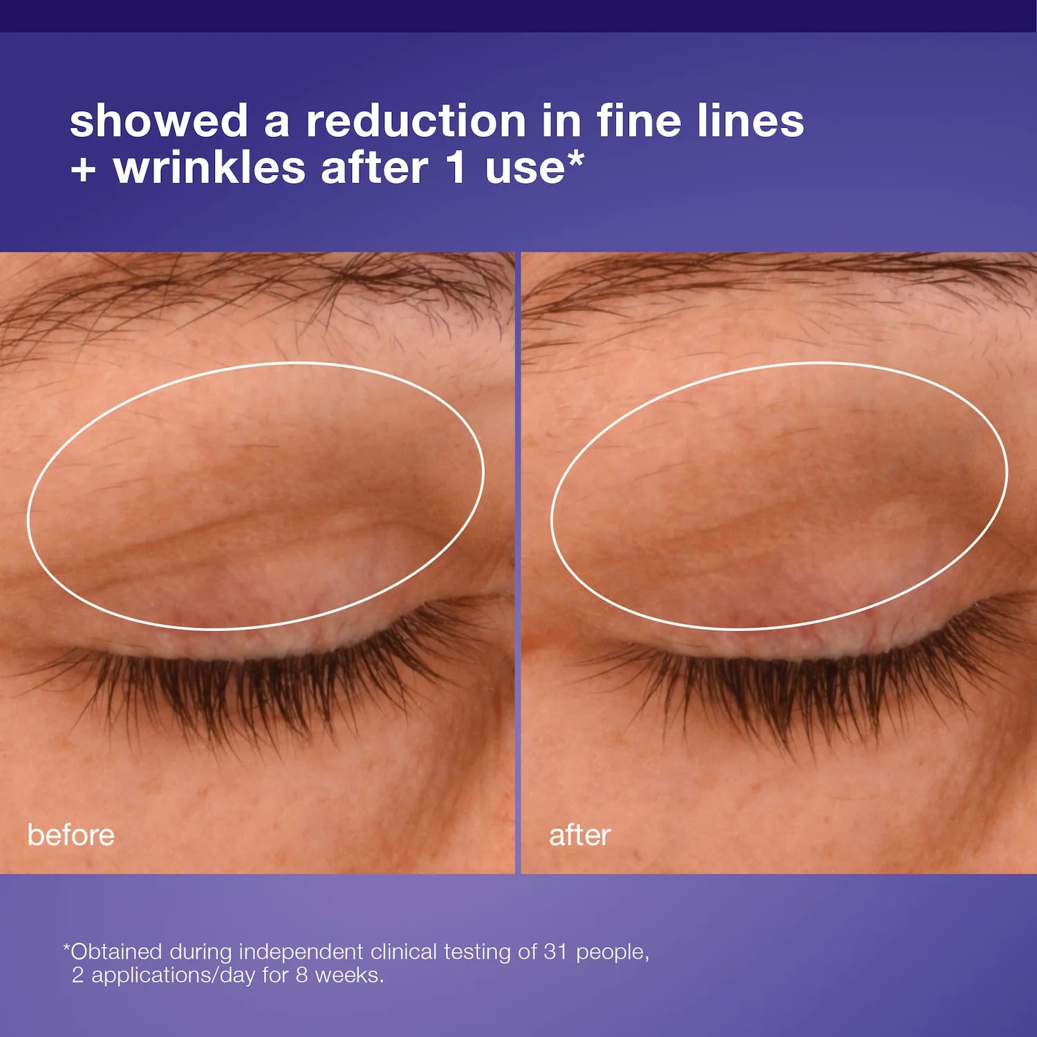 Dermalogica | Phyto Nature Lifting Eye Cream