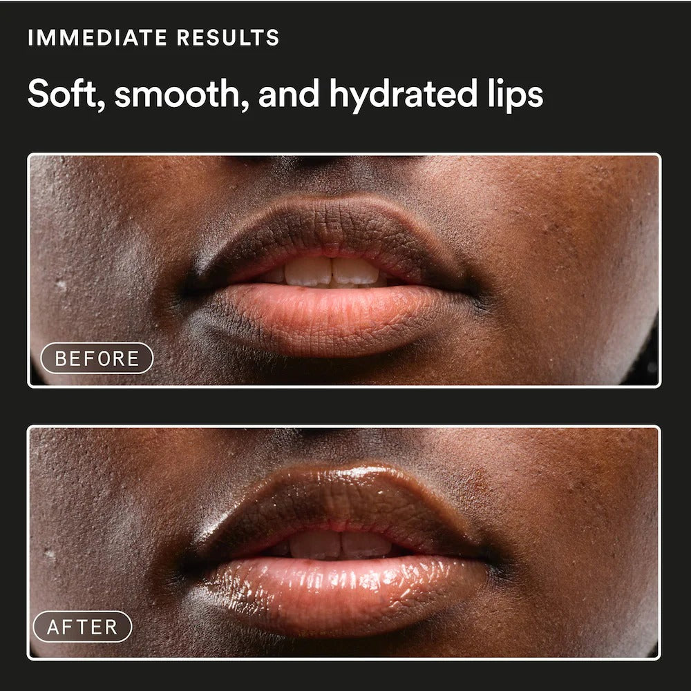 Experiment | Softwear Exfoliating and Hydrating Daily Lip Treatment with Squalane + AHA